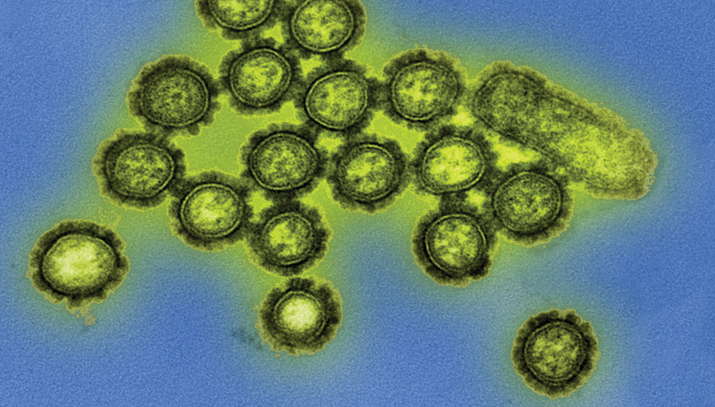 Colorized transmission electron micrograph showing H1N1 virus particles. Surface proteins on the virus particles are shown in black. Credit: NIAID
