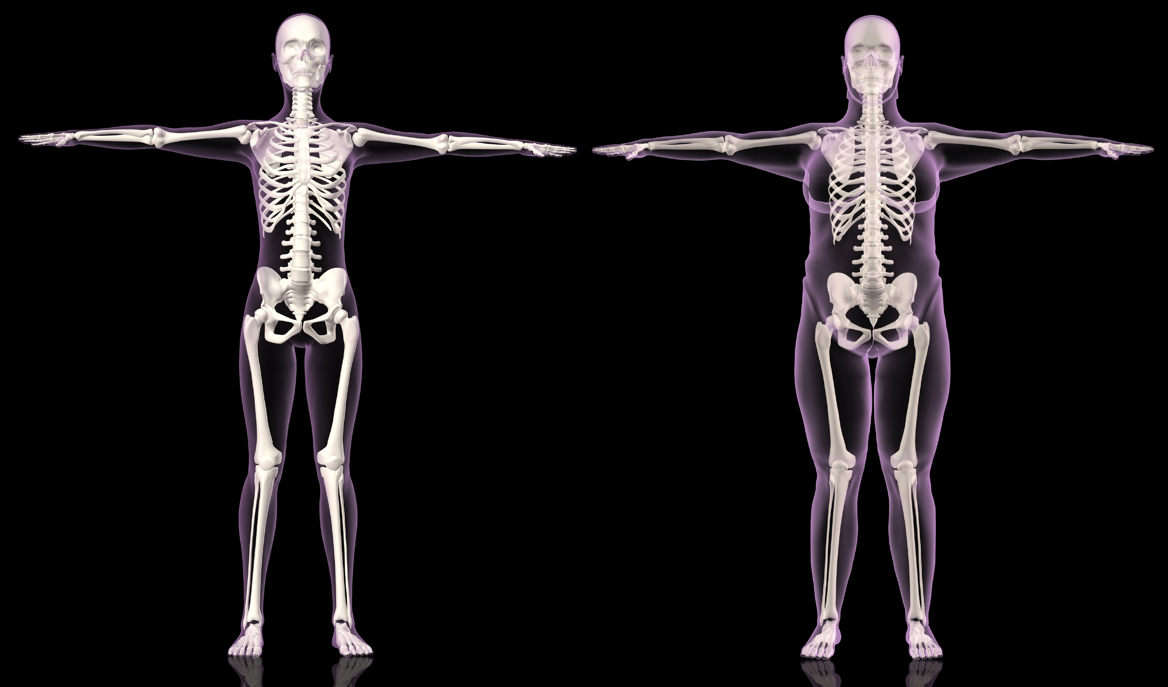 illustration of skeletons: one of ideal weight, one that is obese