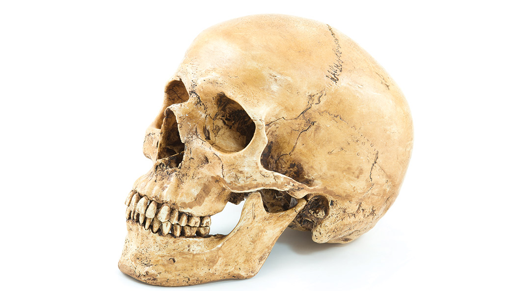 A human skull.