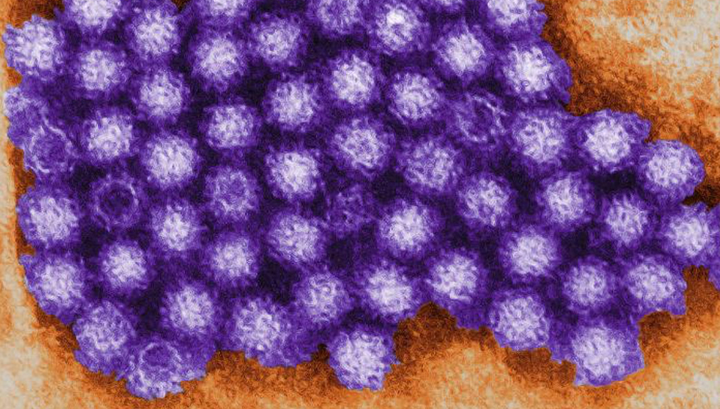 microscopy image of norovirus