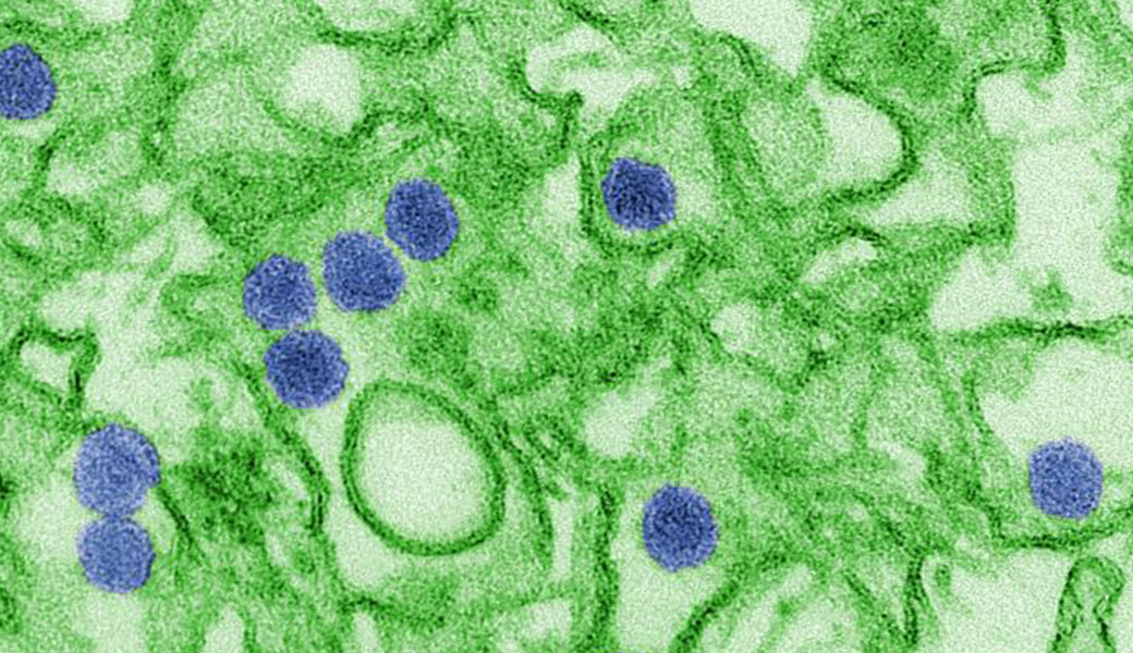 Microscopic image of Ebola cells