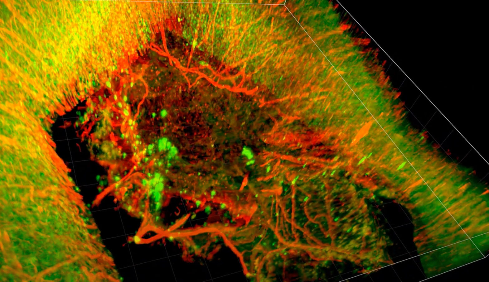 3D imagery of a rat brain treated with brain glue following severe traumatic brain injury