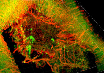 3D imagery of a rat brain treated with brain glue following severe traumatic brain injury