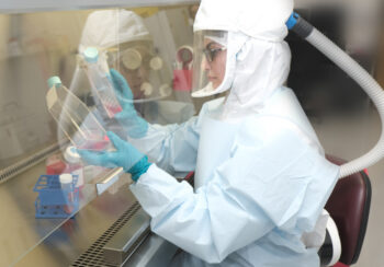 UGA study determines why some COVID patients have GI symptoms