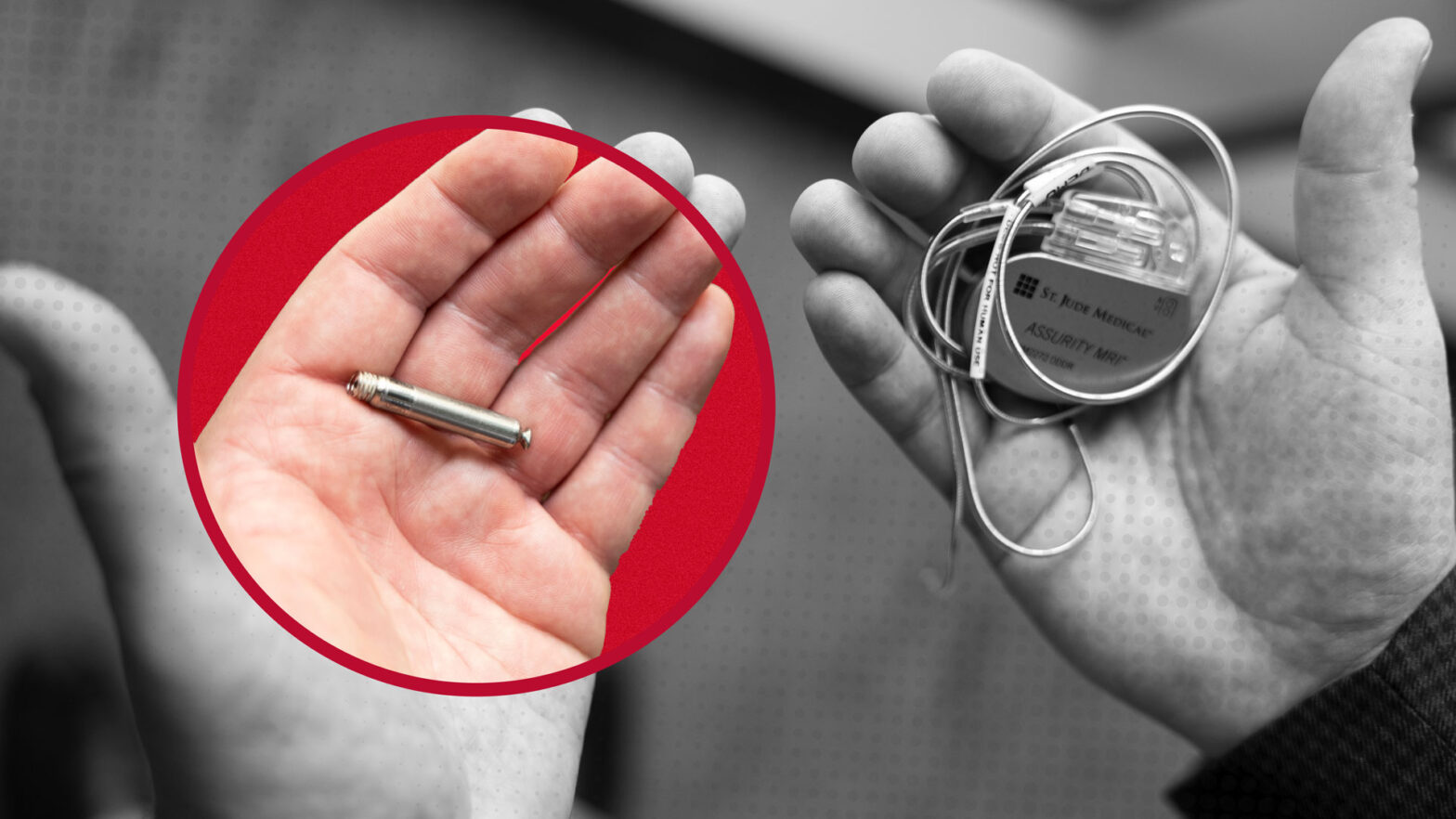wireless peacemaker in the left hand compared to a wired pacemaker in the right hand.