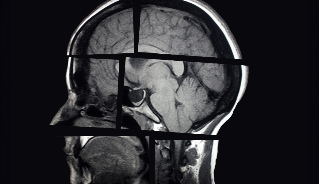 x-ray image of the human brain.