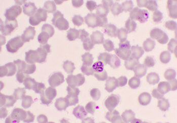 Plasmodium falciparum