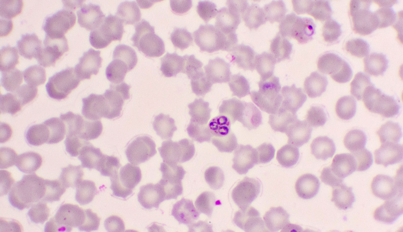 Plasmodium falciparum