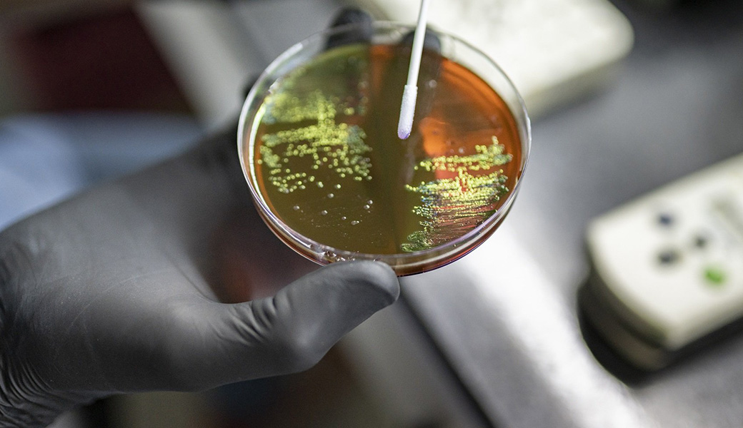A gloved hand holds a Petri dish containing samples of bacteria.