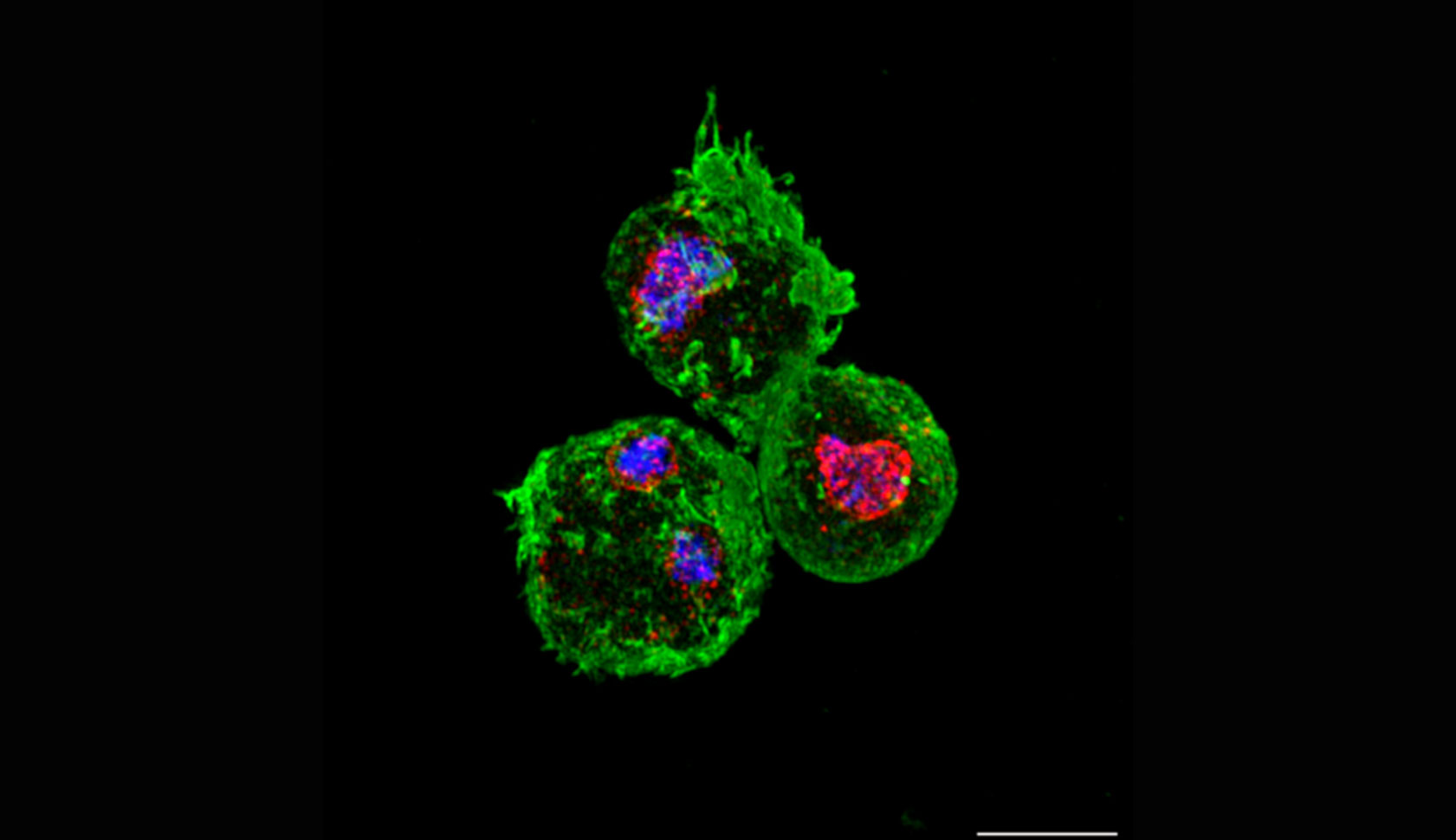 Dictyostelium is an amoeba that crawls on glass. The green stain prominently displays its cytoskeleton after cells were fixed and permeabilized, using an anti-actin antibody. The new anti-O-fucose antibody, created by Megna Tiwari, illustrates in red the concentration of O-fucose proteins within the nucleus, highlighted by the blue dye. One of the cells has 2 nuclei, and the white bar measures 5 microns.