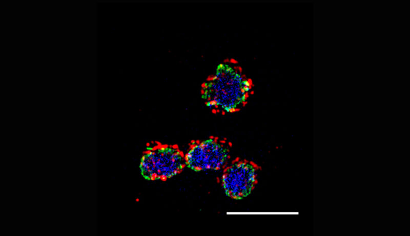 When we zoom in on several amoebae, we can highlight the nuclei, stained green with anti-epichromatin antibody. This emphasizes the enrichment of O-fucose proteins (in red) near the nuclear periphery. The blue DNA dye (DAPI) also images the nucleus.