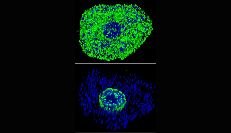 Free living trophozoites, the disease-causing life stage of the amoeba Acanthamoeba castellanii that causes a painful and sometimes blinding eye infection, were allowed to attach to glass and then fixed and permeabilized for detecting fucose epitopes. The top panel probes with a lectin specific for any terminal fucose residue and the bottom panel probes with our antibody specific for O-fucose on proteins.
