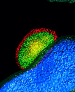This image shows a Plasmodium parasite (green) being surrounded and attacked by guanylate binding proteins (red), the host's defense. The host cell nucleus is shown in blue. All of this action happens within the host’s liver cell, and Sam Kurup is trying to determine how the parasite is able to thwart such an attack. (Image courtesy of Kurup lab)